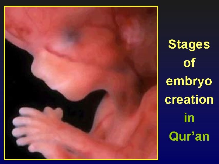 Stages of embryo creation in Qur’an 