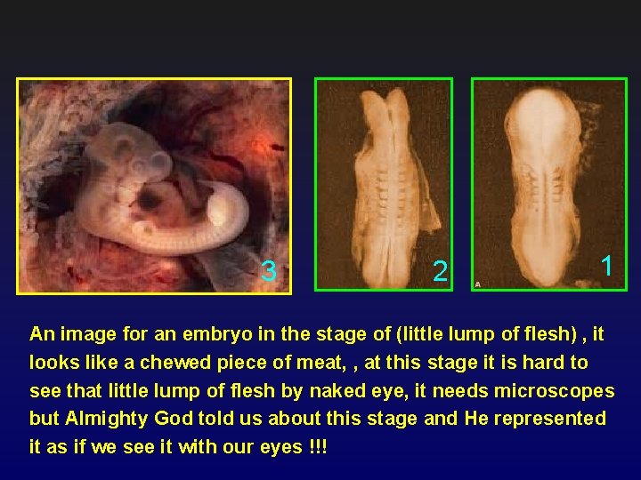 3 2 1 An image for an embryo in the stage of (little lump