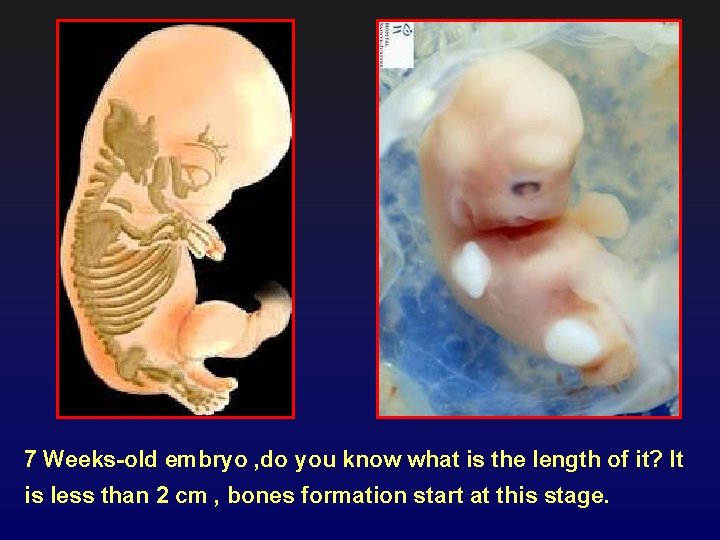 7 Weeks-old embryo , do you know what is the length of it? It