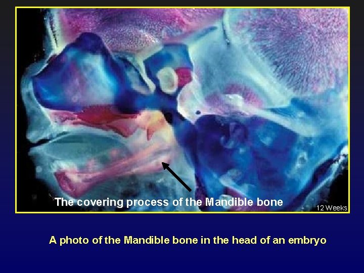 The covering process of the Mandible bone 12 Weeks A photo of the Mandible