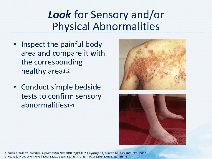 Look for Sensory and/or Physical Abnormalities • Inspect the painful body area and compare Look for Sensory and/or Physical Abnormalities • Inspect the painful body area and compare