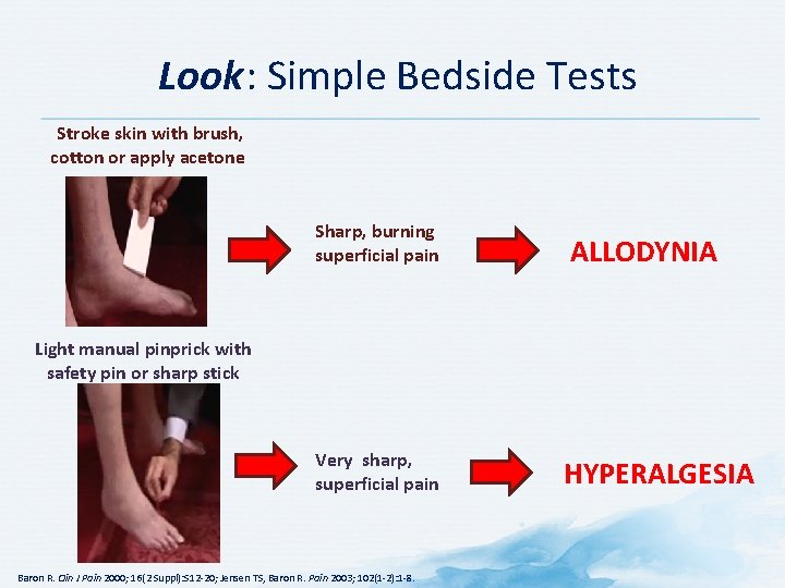 Look: Simple Bedside Tests Stroke skin with brush, cotton or apply acetone Sharp, burning Look: Simple Bedside Tests Stroke skin with brush, cotton or apply acetone Sharp, burning