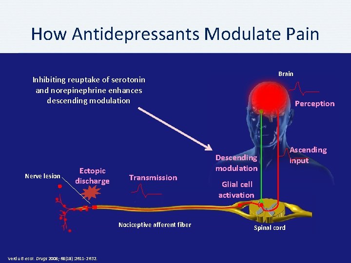 How Antidepressants Modulate Pain Brain Inhibiting reuptake of serotonin and norepinephrine enhances descending modulation How Antidepressants Modulate Pain Brain Inhibiting reuptake of serotonin and norepinephrine enhances descending modulation