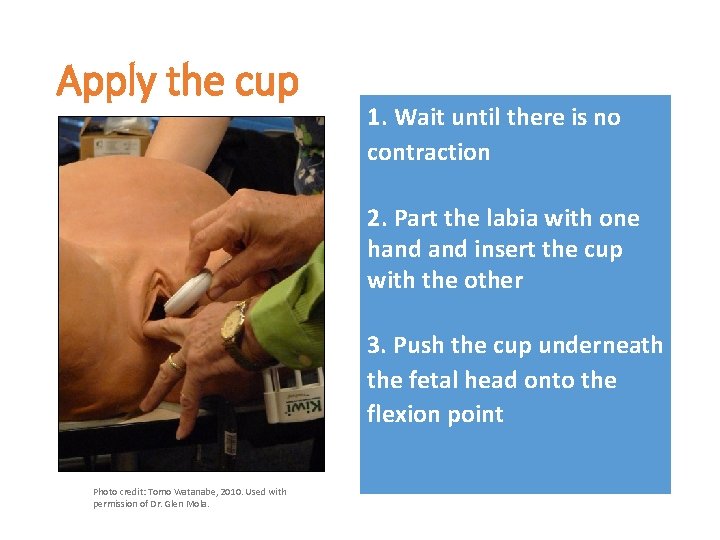 Apply the cup 1. Wait until there is no contraction 2. Part the labia