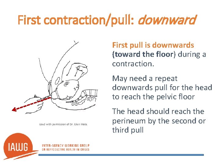 First contraction/pull: downward First pull is downwards (toward the floor) during a contraction. May