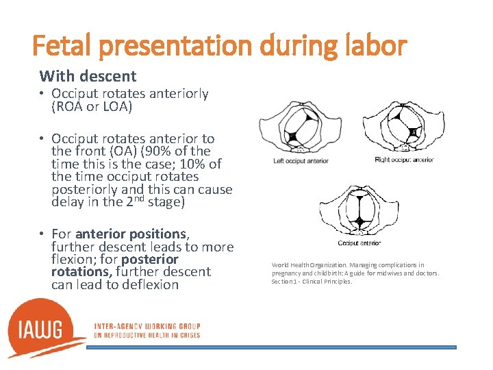 Fetal presentation during labor With descent • Occiput rotates anteriorly (ROA or LOA) •