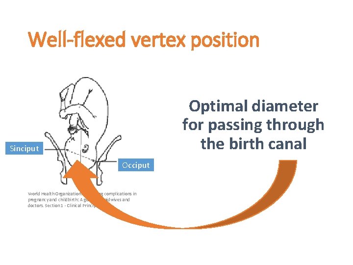 Well-flexed vertex position Optimal diameter for passing through the birth canal Sinciput Occiput World