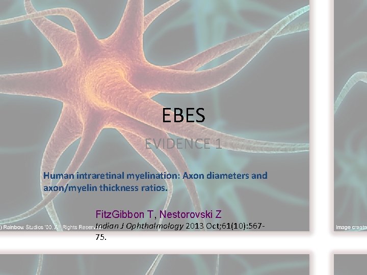 EBES EVIDENCE 1 Human intraretinal myelination: Axon diameters and axon/myelin thickness ratios. Fitz. Gibbon
