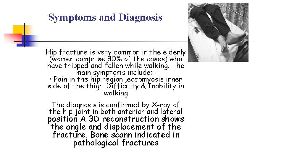 Symptoms and Diagnosis Hip fracture is very common in the elderly (women comprise 80%