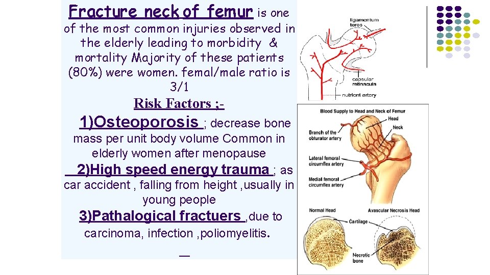 Fracture neck of femur is one of the most common injuries observed in the