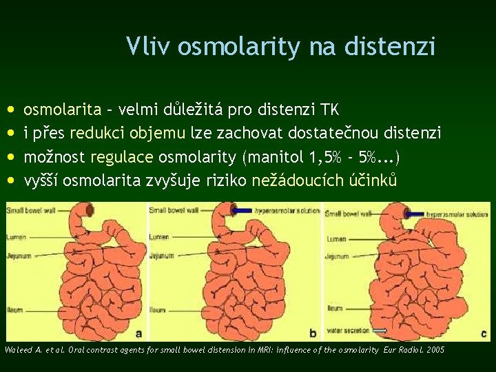 Vliv osmolarity na distenzi • • osmolarita – velmi důležitá pro distenzi TK i