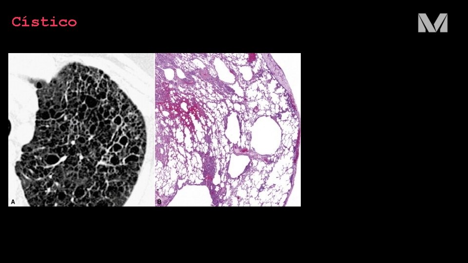 Cístico 
