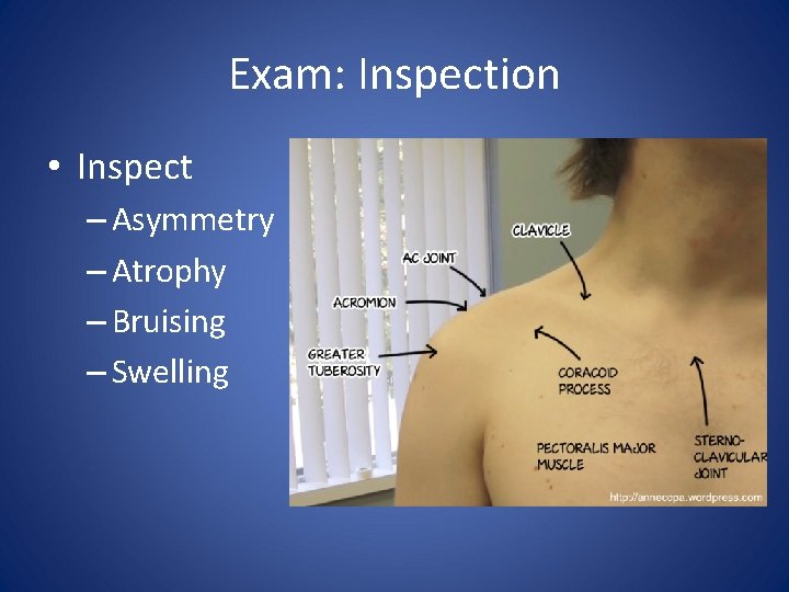 Exam: Inspection • Inspect – Asymmetry – Atrophy – Bruising – Swelling 