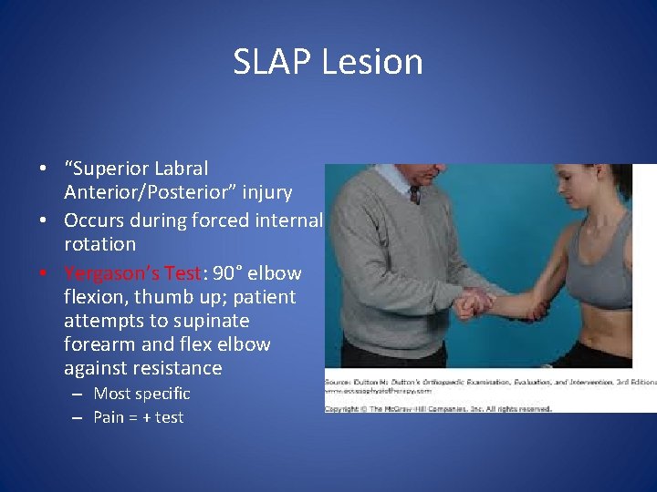 SLAP Lesion • “Superior Labral Anterior/Posterior” injury • Occurs during forced internal rotation •