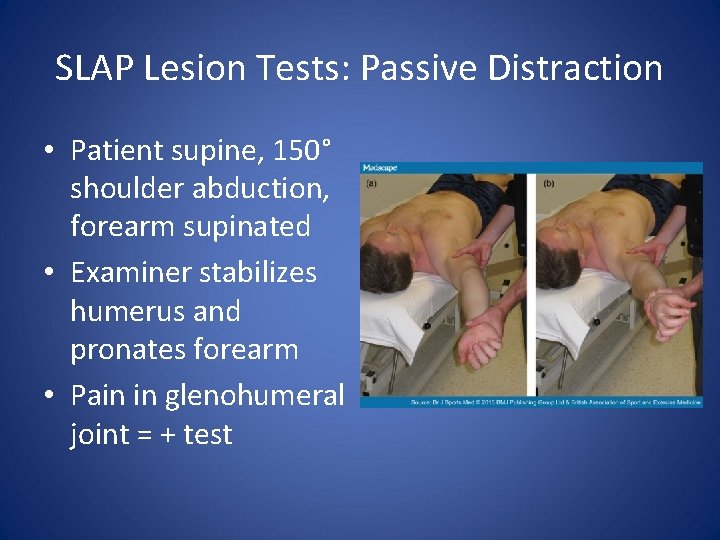 SLAP Lesion Tests: Passive Distraction • Patient supine, 150° shoulder abduction, forearm supinated •