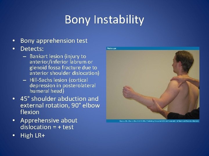 Bony Instability • Bony apprehension test • Detects: – Bankart lesion (injury to anterior/inferior