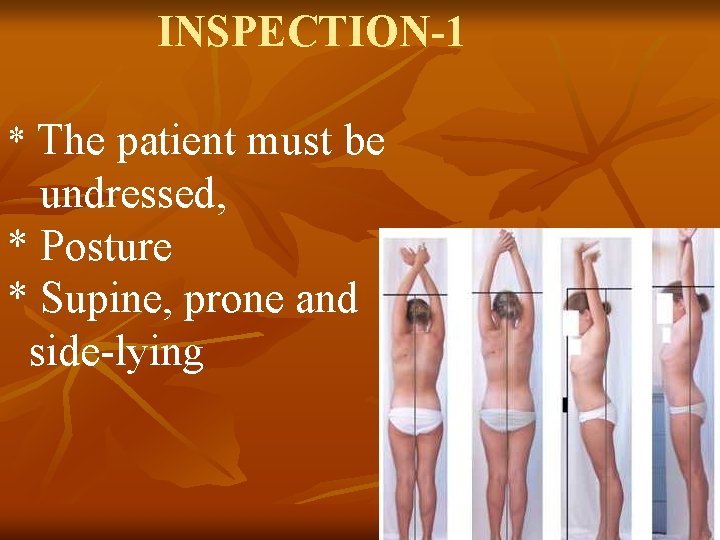 INSPECTION-1 * The patient must be undressed, * Posture * Supine, prone and side-lying