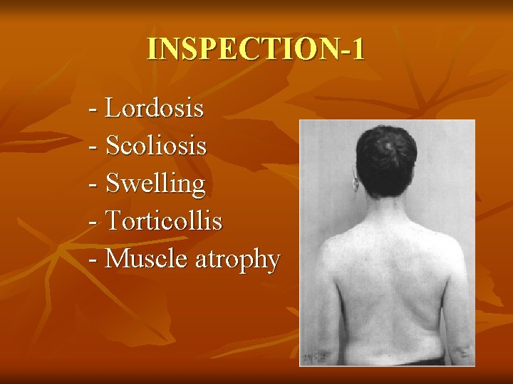 INSPECTION-1 - Lordosis - Scoliosis - Swelling - Torticollis - Muscle atrophy 