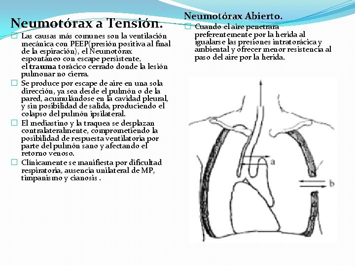 Neumotórax a Tensión. � Las causas más comunes son la ventilación mecánica con PEEP(presión