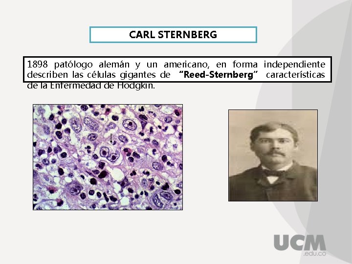 CARL STERNBERG 1898 patólogo alemán y un americano, en forma independiente describen las células