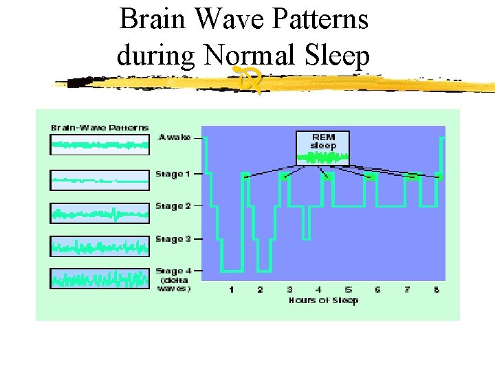 Brain Wave Patterns during Normal Sleep 