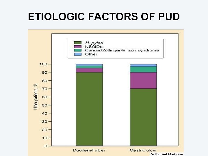 ETIOLOGIC FACTORS OF PUD 