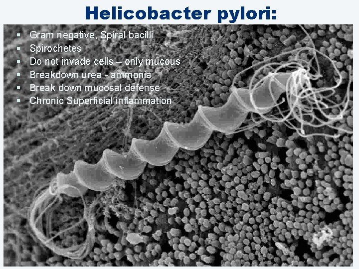 Helicobacter pylori: § § § Gram negative, Spiral bacilli Spirochetes Do not invade cells