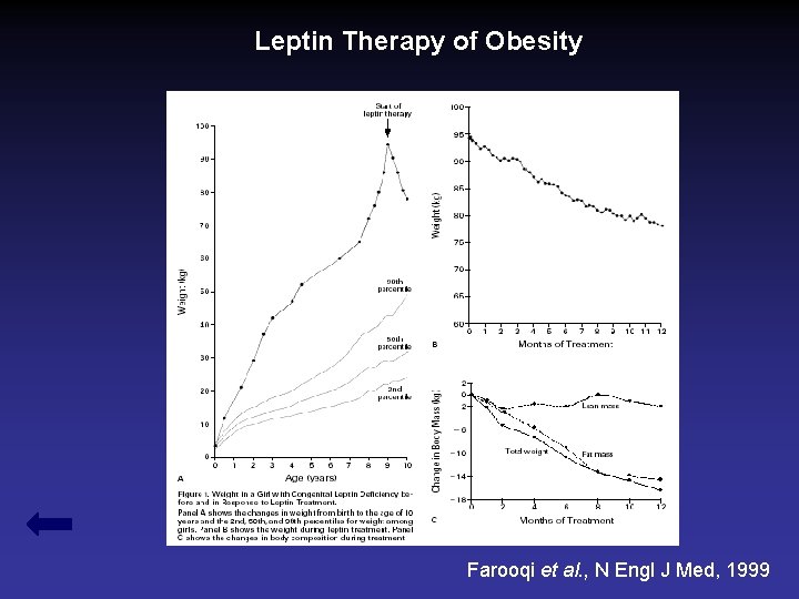 Leptin Therapy of Obesity Farooqi et al. , N Engl J Med, 1999 