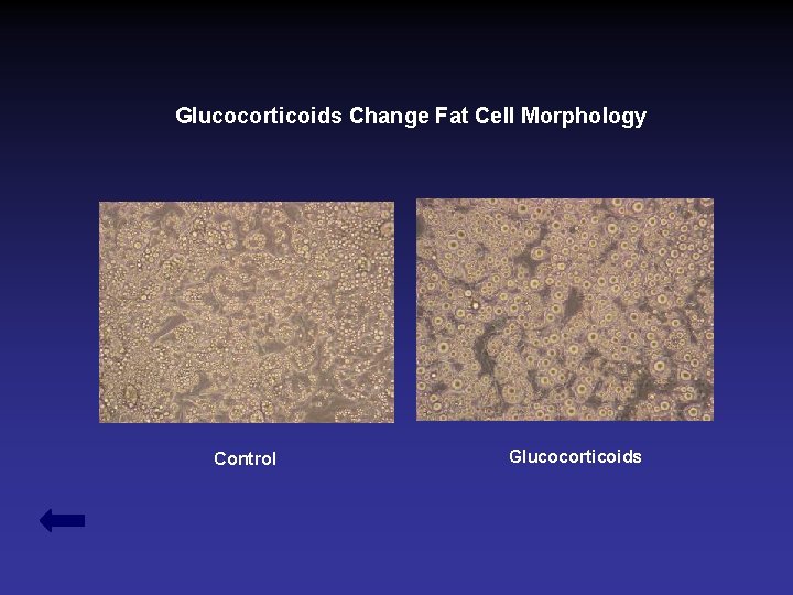 Glucocorticoids Change Fat Cell Morphology Control Glucocorticoids 