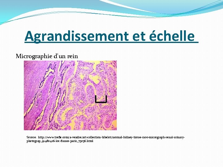 Agrandissement et échelle Micrographie d’un rein Source: http: //www. trefle. com/a-vendre/art-collection-bibelot/normal-kidney-tissue-x 100 -micrograph-renal-urinaryphotograp_91480426 -loc-france-paris_75056.