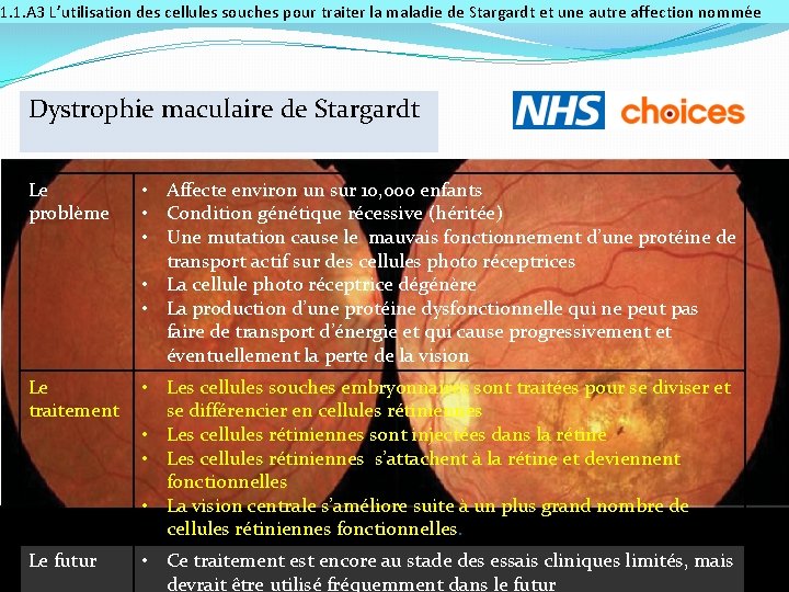 1. 1. A 3 L’utilisation des cellules souches pour traiter la maladie de Stargardt