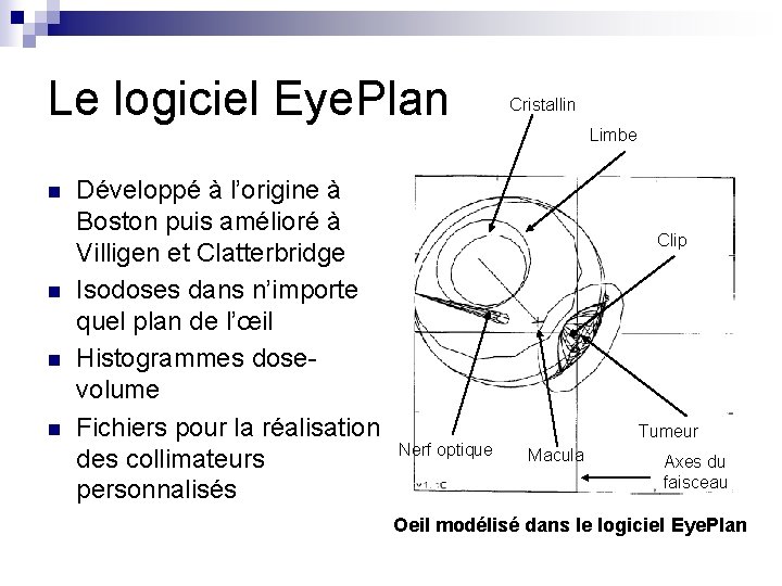 Le logiciel Eye. Plan Cristallin Limbe n n Développé à l’origine à Boston puis