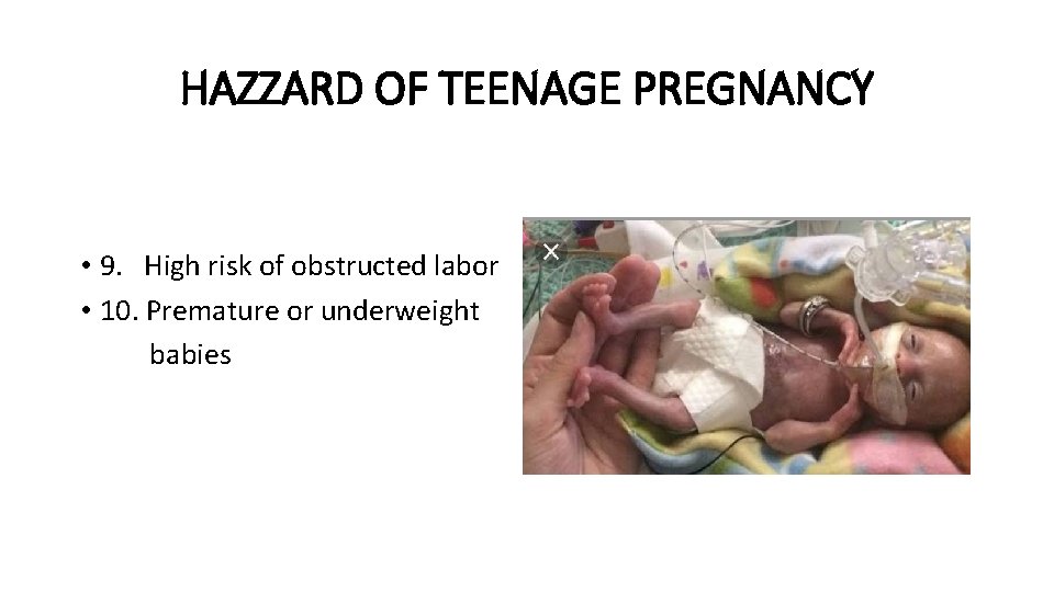 HAZZARD OF TEENAGE PREGNANCY • 9. High risk of obstructed labor • 10. Premature