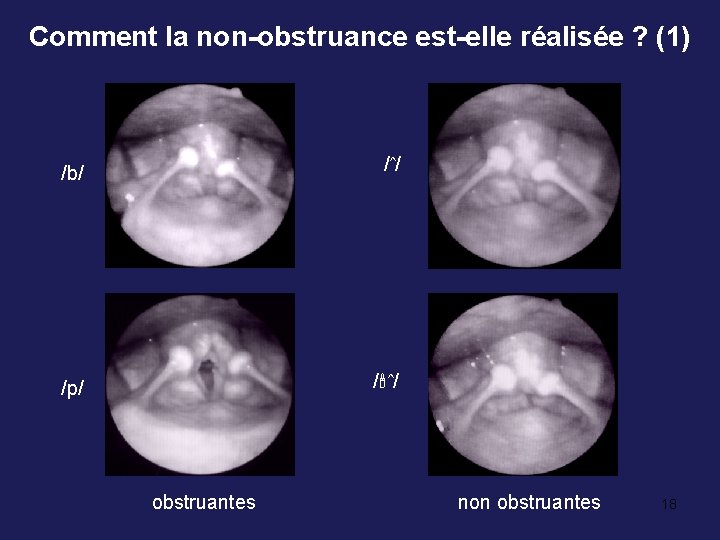 Comment la non-obstruance est-elle réalisée ? (1) /b/ /ˆ/ /p/ / ˆ/ obstruantes non