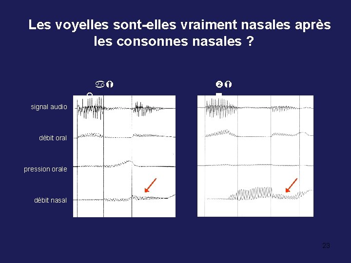 Les voyelles sont-elles vraiment nasales après les consonnes nasales ? aÝ signal audio d