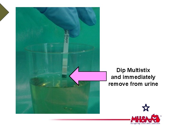 Dip Multistix and immediately remove from urine 