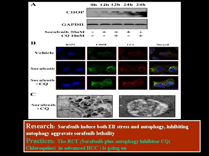 Research: Sorafenib induce both ER stress and autophagy, inhibiting autophagy aggravate sorafenib lethality Practices: