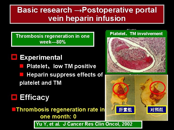 Basic research →Postoperative portal vein heparin infusion Thrombosis regeneration in one week— 80% Platelet、TM