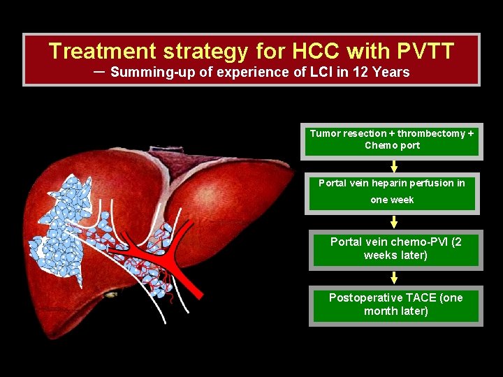 Treatment strategy for HCC with PVTT － Summing-up of experience of LCI in 12