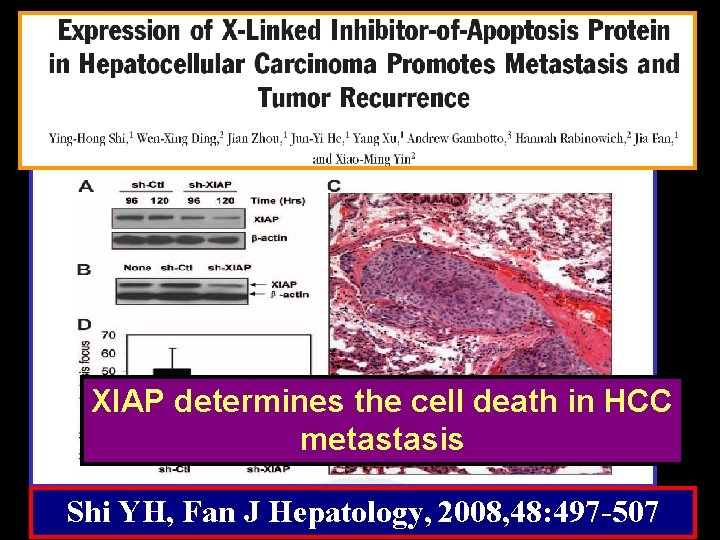 XIAP determines the cell death in HCC metastasis Shi YH, Fan J Hepatology, 2008,