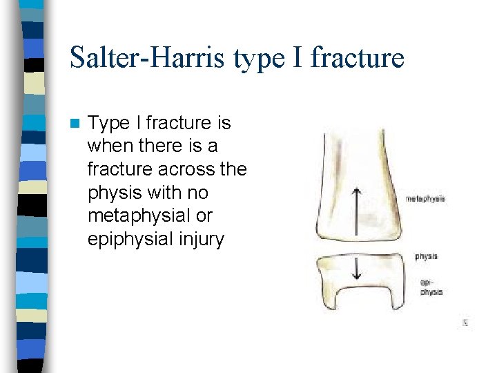 Salter-Harris type I fracture n Type I fracture is when there is a fracture