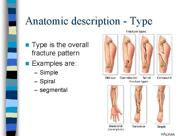 Anatomic description - Type is the overall fracture pattern n Examples are: n –