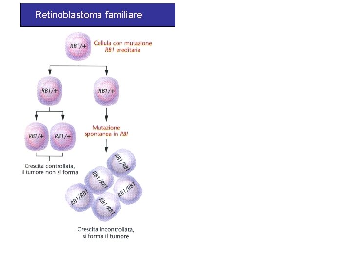 Retinoblastoma familiare Retinoblastoma sporadico 