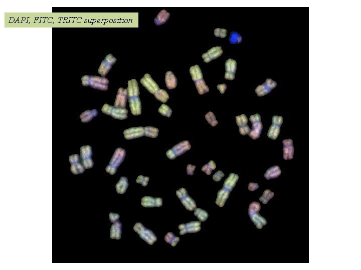 DAPI, FITC, TRITC superposition 