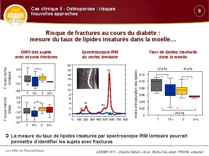 Cas clinique II - Ostéoporose : risques Nouvelles approches 9 Risque de fractures au