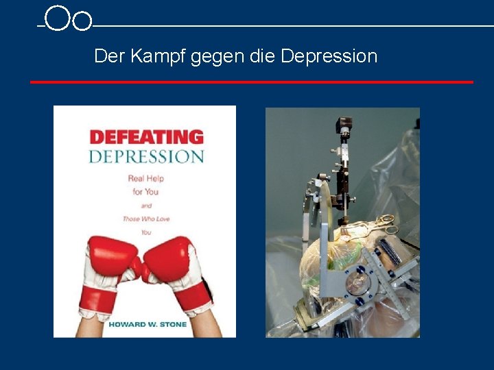 Der Kampf gegen die Depression 