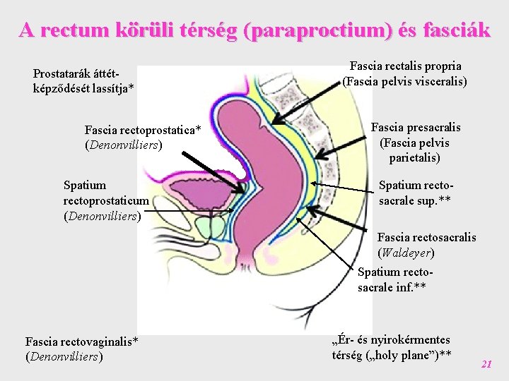 A rectum körüli térség (paraproctium) és fasciák Prostatarák áttétképződését lassítja* Fascia rectoprostatica* (Denonvilliers) Spatium