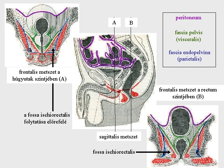 A B peritoneum fascia pelvis (visceralis) fascia endopelvina (parietalis) frontalis metszet a húgyutak szintjében