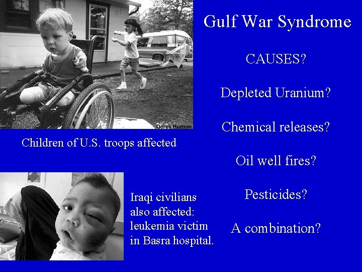 Gulf War Syndrome CAUSES? Depleted Uranium? Chemical releases? Children of U. S. troops affected