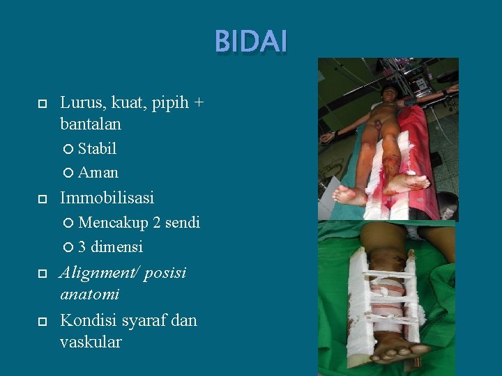 BIDAI Lurus, kuat, pipih + bantalan Stabil Aman Immobilisasi Mencakup 3 2 sendi dimensi